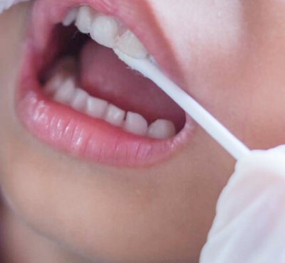 Dental Examination